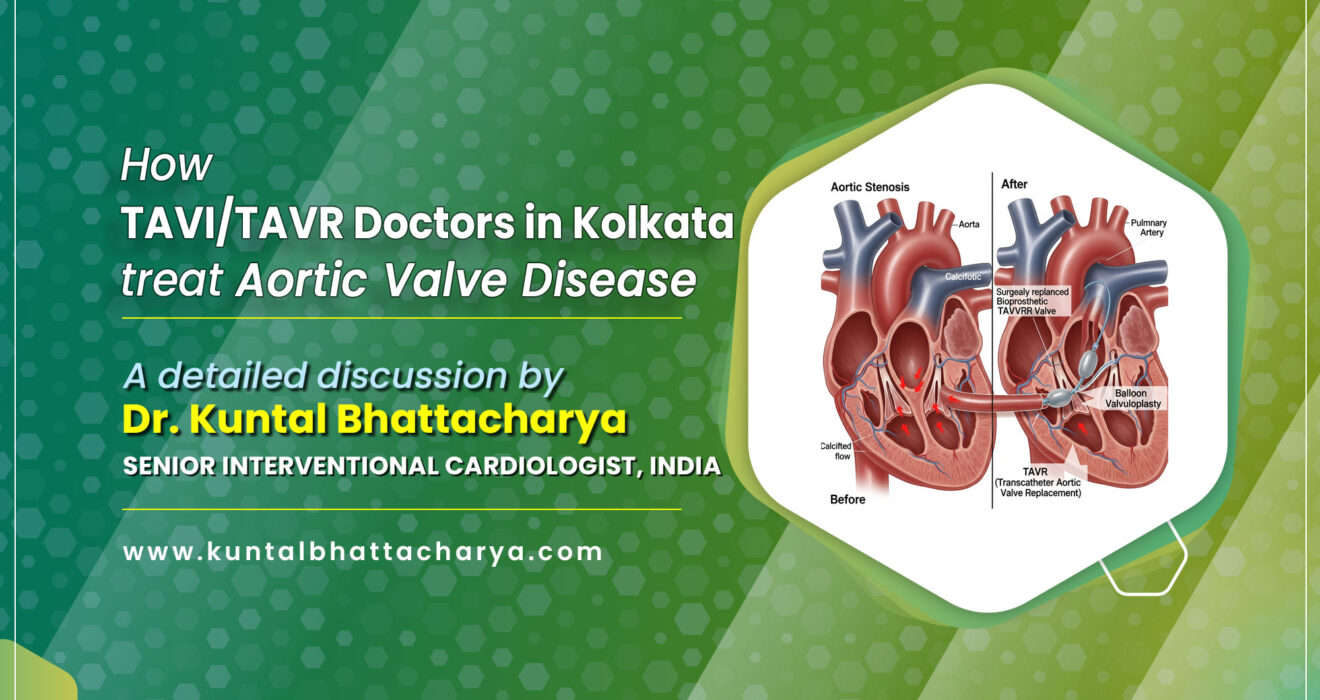 How TAVI/TAVR Doctors in Kolkata treat Aortic Valve Disease?- A Simple Guide by Dr. Kuntal Bhattacharya, best TAVI doctor in Kolkata