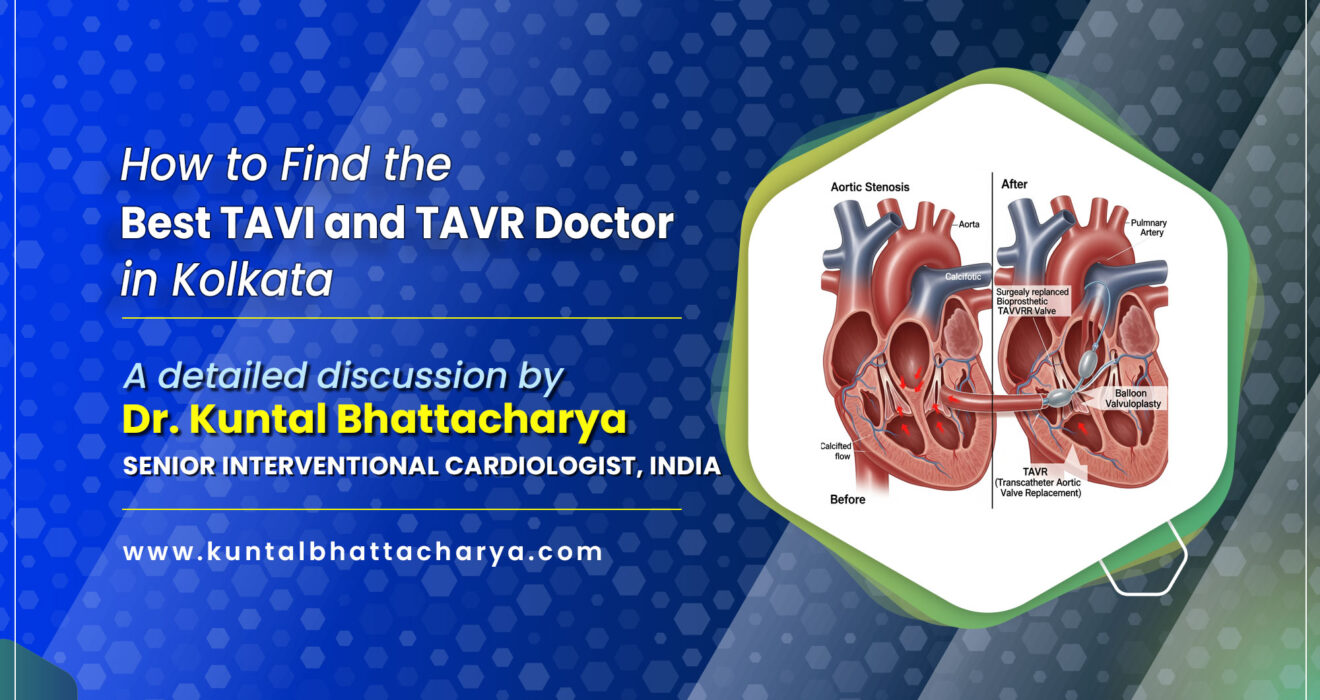 How to Find the Best TAVI and TAVR Doctor in Kolkata in 2025?