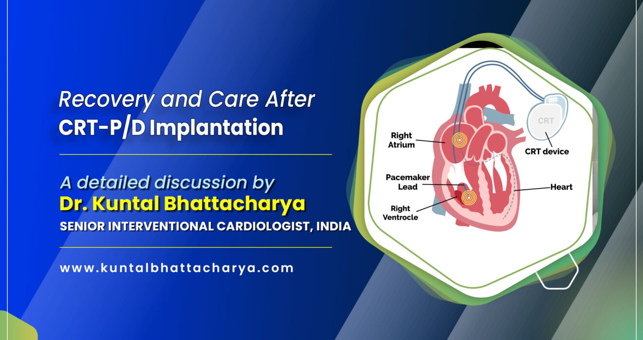 Recovery and Care After CRT-P/D Implantation - Dr. Kuntal Bhattacharya, best cardiac device doctor in Kolkata, India
