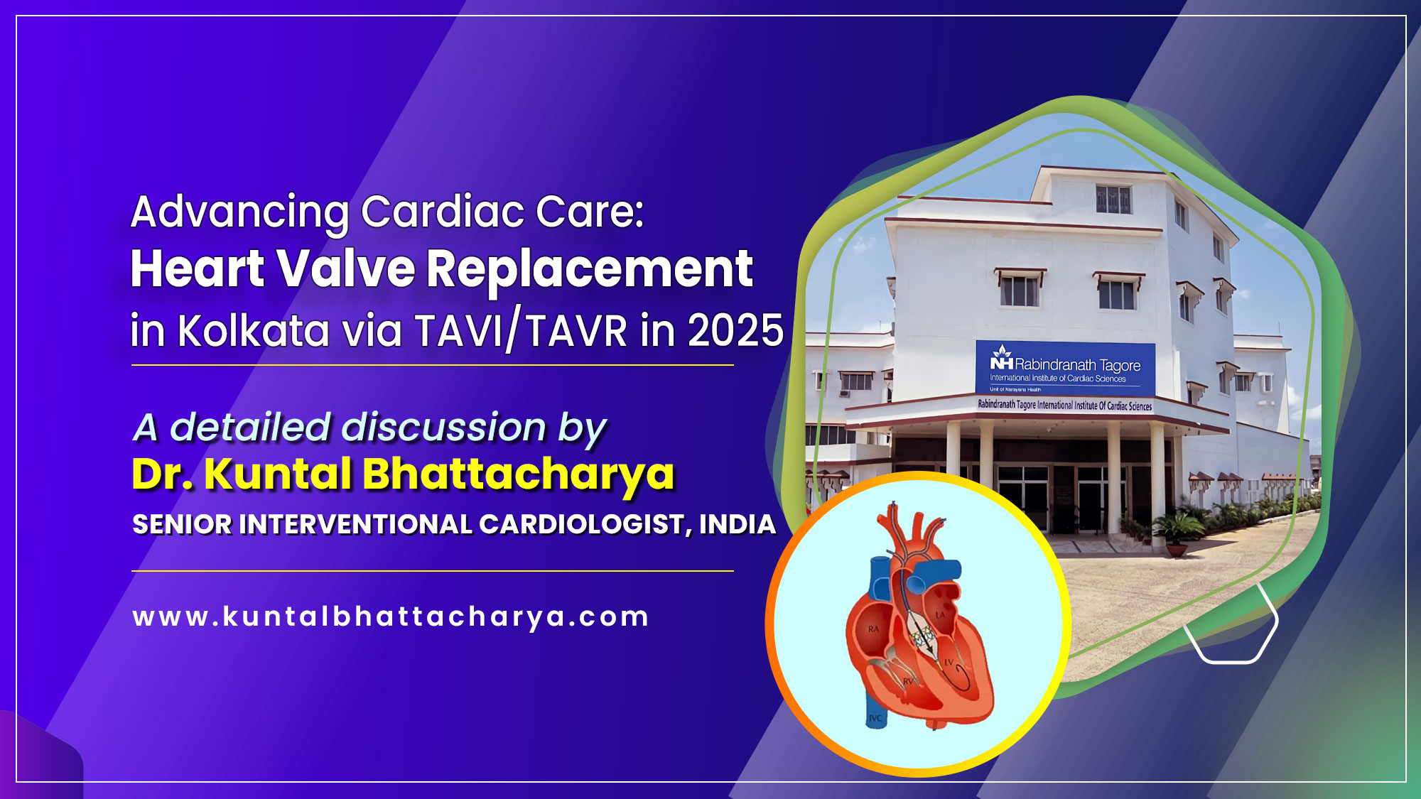 A Comprehensive Guide on “Advancing Cardiac Care: Heart Valve Replacement in Kolkata via TAVI/TAVR in 2025” by Dr. Kuntal Bhattacharya, Sr. Consultant Interventional Cardiologist, Kolkata