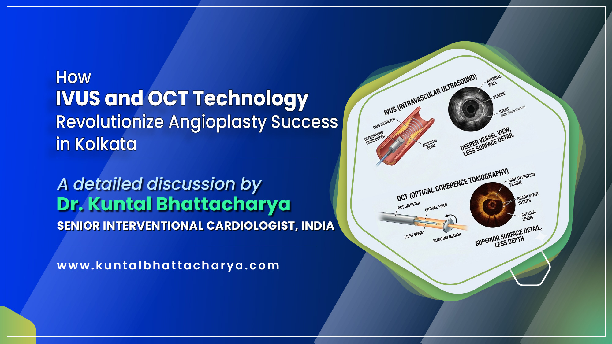 A detailed discussion on “How IVUS and OCT Technology Revolutionized Angioplasty Success in Kolkata” by Dr. Kuntal Bhattacharya, Sr. Consultant Interventional Cardiologist, Kolkata