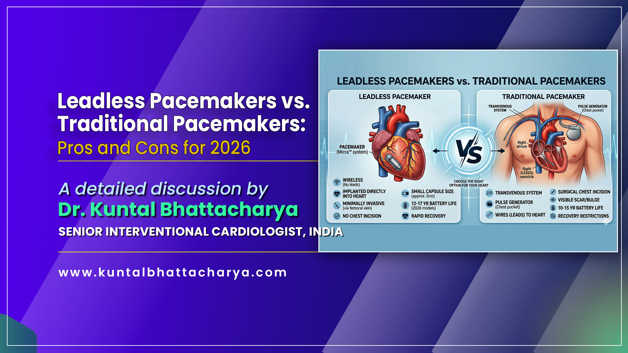 'Leadless Pacemakers vs. Traditional Pacemakers: Pros and Cons for 2026' - From the desk of Dr. Kuntal Bhattacharya Senior Interventional Cardiologist, Narayana Health – RN Tagore Hospital, Kolkata