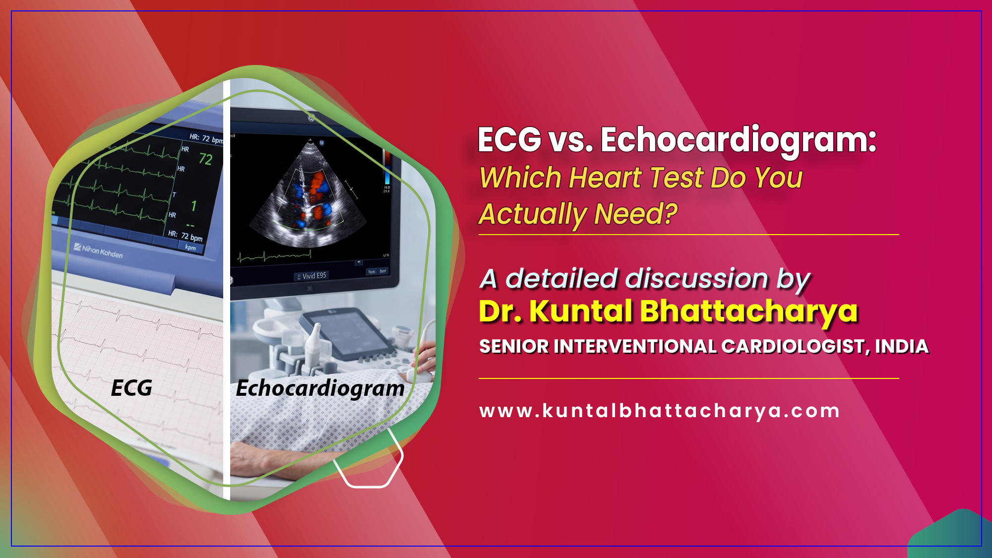‘ECG vs. Echocardiogram: Which Heart Test Do You Actually Need?’ – an ultimate guide by Dr. Kuntal Bhattacharya, Interventional Cardiologist, Narayana Health